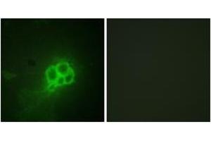 Immunofluorescence analysis of HuvEc cells, using Tryptophan Hydroxylase (Ab-260) Antibody. (Tryptophan Hydroxylase 1 Antikörper  (AA 231-280))