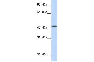 Western Blotting (WB) image for anti-DENN/MADD Domain Containing 1B (DENND1B) antibody (ABIN2459575) (DENND1B Antikörper)