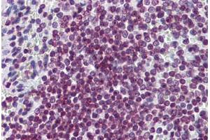 Human Spleen: Formalin-Fixed, Paraffin-Embedded (FFPE) (FOXO3 Antikörper  (AA 361-460))