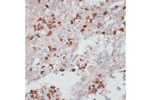 Immunohistochemistry (IHC) image for anti-Cathepsin G (CTSG) (AA 75-190) antibody (ABIN6139228)