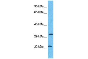 Host:  Rabbit  Target Name:  MINA  Sample Type:  Breast Tumor lysates  Antibody Dilution:  1. (MINA Antikörper  (C-Term))