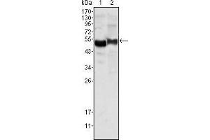 Western blot analysis using AAT mouse mAb against human plasma (1) and NIH/3T3 cell lysate (2). (AAT Antikörper)