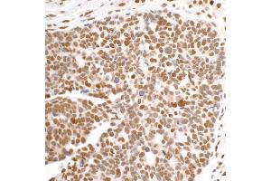 Immunohistochemistry (IHC) image for anti-DEAD (Asp-Glu-Ala-Asp) Box Polypeptide 1 (DDX1) (C-Term) antibody (ABIN7453882) (DDX1 Antikörper  (C-Term))
