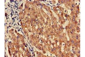 Immunohistochemistry of paraffin-embedded human liver tissue using ABIN7162462 at dilution of 1:100 (SLC1A3 Antikörper  (AA 7-151))
