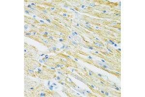 Immunohistochemistry of paraffin-embedded mouse heart using SLC19A1 antibody (ABIN6291462) at dilution of 1:100 (40x lens). (SLC19A1 Antikörper)