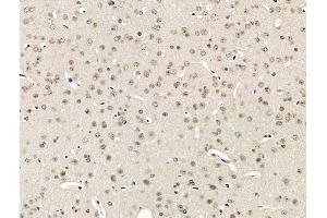 ABIN6264251 and ABIN6266824 at 1/100 staining Mouse brain tissue by IHC-P. (PKCB1 Antikörper  (Internal Region))