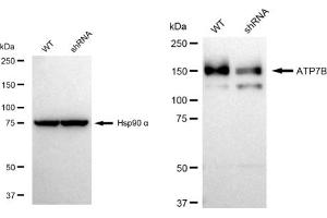 Western blotting analysis using ATP7B antibody (ABIN7797696). (Rekombinanter ATP7B Antikörper)