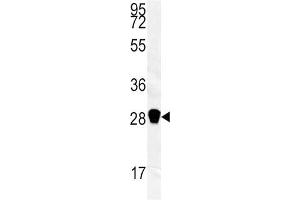 Western Blotting (WB) image for anti-Carbonic Anhydrase III (CA3) antibody (ABIN3003364) (CA3 Antikörper)
