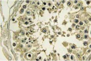 Immunohistochemistry analyzes of Hrs antibody in paraffin-embedded Human testis tissue. (HGS Antikörper)