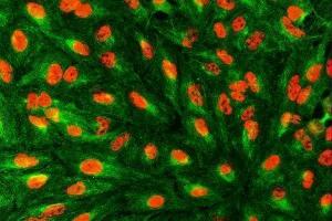 IF analysis of SART1 using anti-SART1 antibody (ABIN7599884) and anti-Beta Tubulin antibody (ABIN7602743). (SART1 Antikörper  (AA 125-800))