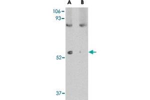 Western blot analysis of LGI1 in mouse brain tissue lysate with LGI1 polyclonal antibody  at 1 ug/mL in (A) the absence and (B) the presence of blocking peptide.