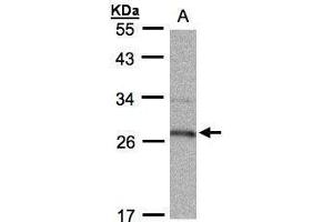 WB Image Sample (30μg whole cell lysate) A:Raji , 12% SDS PAGE antibody diluted at 1:1000 (HPGD Antikörper  (C-Term))
