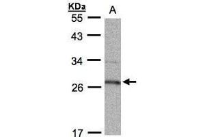 HPGD Antikörper  (C-Term)