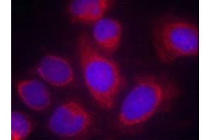 Immunofluorescence staining of methanol-fixed Hela cells using CPI17a(Ab-38) Antibody. (CPI-17 Antikörper)