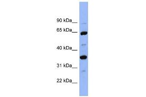 WB Suggested Anti-SERPINC1 Antibody Titration:  0. (SERPINC1 Antikörper  (Middle Region))