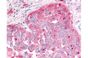 Immunohistochemistry (IHC) image for anti-ADAM Metallopeptidase with thrombospondin Type 1 Motif, 5 (ADAMTS5) (C-Term) antibody (ABIN1048296)