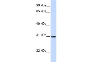 WB Suggested Anti-ATF5 Antibody Titration: 0. (ATF5 Antikörper  (Middle Region))