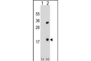Western blot analysis of PLA2G1B (arrow) using rabbit polyclonal PLA2G1B Antibody (C-term) (ABIN651072 and ABIN2840059). (PLA2G1B Antikörper  (C-Term))