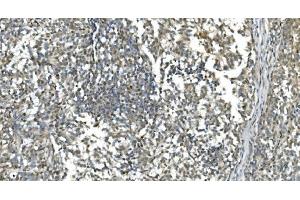 IHC analysis of LSM7 using anti-LSM7 antibody (ABIN7598937).