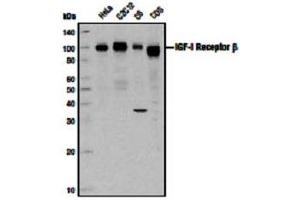 Image no. 3 for anti-Insulin-Like Growth Factor 1 Receptor (IGF1R) (C-Term) antibody (ABIN228595) (IGF1R Antikörper  (C-Term))