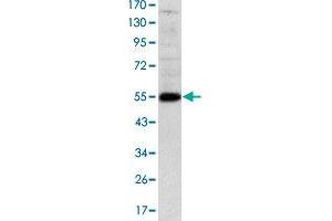Western blot analysis using LHX2 monoclonal antibody, clone 6G2  against human LHX2 (aa: 200-406) recombinant protein.