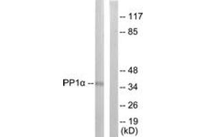 Western Blotting (WB) image for anti-Protein Phosphatase 1, Catalytic Subunit, alpha Isoform (PPP1CA) (AA 281-330), (pThr320) antibody (ABIN482082) (PPP1CA Antikörper  (pThr320))