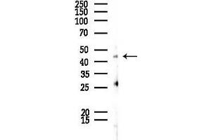 Western blot analysis of lysates from EC304 cells, using SERPINE2 Antibody at 1/1000 dilution.