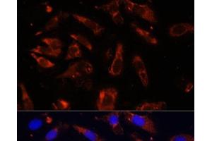 Immunofluorescence analysis of U-2OS cells using MCTS1 Polyclonal Antibody at dilution of 1:100 (40x lens).