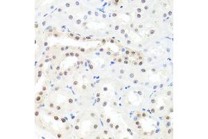 Immunohistochemistry of paraffin-embedded rat kidney using HNRNPCL1 antibody (ABIN5995850) at dilution of 1/100 (40x lens). (HNRNPCL1 Antikörper)