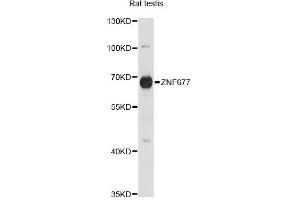 Western blot analysis of extracts of rat testis, using ZNF677 antibody. (ZNF677 Antikörper)