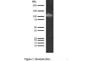 Western Blotting (WB) image for anti-ADAM Metallopeptidase with Thrombospondin Type 1 Motif, 13 (ADAMTS13) antibody (ABIN5566846)