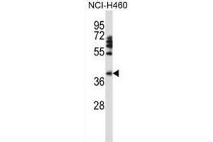 Western Blotting (WB) image for anti-Forkhead Box D1 (FOXD1) antibody (ABIN2997954) (FOXD1 Antikörper)