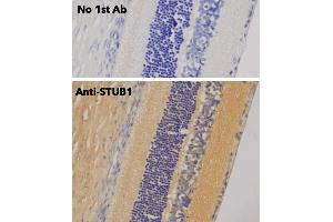 Immunohistochemistry (IHC) image for anti-STIP1 Homology and U-Box Containing Protein 1 (STUB1) antibody (ABIN6254206) (STUB1 Antikörper)