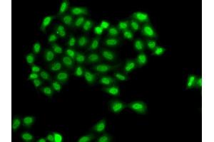 Immunofluorescence analysis of A549 cells using PHF11 antibody. (PHF11 Antikörper)