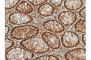 Immunohistochemistry analysis using Rabbit Anti-HSP70 (Acetyl Lys77) Polyclonal Antibody (ABIN5650759).