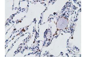 Immunohistochemical staining of paraffin-embedded Human lung tissue using anti-PECR mouse monoclonal antibody. (PECR Antikörper)