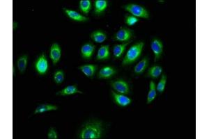 Immunofluorescence staining of A549 cells with ABIN7160339 at 1:100, counter-stained with DAPI. (MEGF9 Antikörper  (AA 49-178))