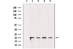 Western blot analysis of lysates from various samples, using DDIT3/CHOP Mouse Monoclonal Antibody.