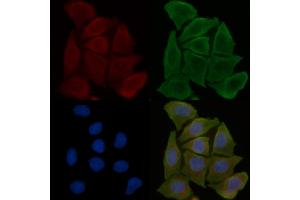 ABIN6258319 and ABIN6275775 staining Hela cells(30 min of UV treatment) by IF/ICC. (IFIT5 Antikörper  (Internal Region))