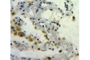 IHC-P analysis of Lung tissue, with DAB staining. (SPARC Antikörper  (AA 18-301))