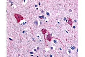 Anti-SLC5A11 antibody IHC of human brain, cortex. (Solute Carrier Family 5 (Sodium/inositol Cotransporter), Member 11 (SLC5A11) (Extracellular Domain) Antikörper)