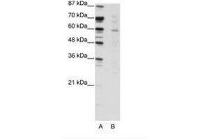 Image no. 1 for anti-Core-binding Factor, Runt Domain, alpha Subunit 2, Translocated To, 3 (CBFA2T3) (N-Term) antibody (ABIN203203) (CBFA2T3 Antikörper  (N-Term))
