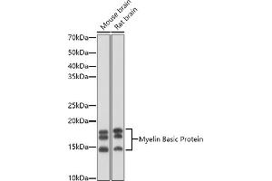 Western blot analysis of extracts of various cell lines, using Myelin Basic Protein antibody (ABIN3022348, ABIN3022349, ABIN3022350 and ABIN6218754) at 1:1000 dilution.