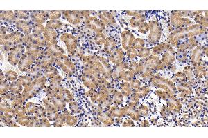 Immunohistochemistry (IHC) image for anti-Interleukin 11 Receptor, alpha (IL11RA) (AA 194-329) antibody (ABIN7438169)