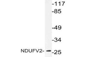 Western blot (WB) analysis of NDUFV2 antibody in extracts from Jurkat cells. (NDUFV2 Antikörper)