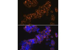 Immunofluorescence analysis of MCF-7 cells using NMD Rabbit mAb (ABIN7267417) at dilution of 1:100 (40x lens). (GRIN1/NMDAR1 Antikörper)