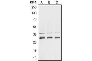 Western blot analysis of hnRNP A1 expression in MCF7 (A), K562 (B), NIH3T3 (C) whole cell lysates. (HNRNPA1 Antikörper  (Center))