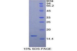 SDS-PAGE (SDS) image for Brain-Derived Neurotrophic Factor (BDNF) (AA 117-248) protein (His tag) (ABIN1880085)