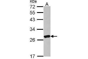 WB Image Sample (30 ug of whole cell lysate) A: IMR32 12% SDS PAGE antibody diluted at 1:500 (ARHGDIA Antikörper)