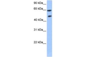 Western Blotting (WB) image for anti-Zinc Finger Protein 449 (ZNF449) antibody (ABIN2460260) (ZNF449 Antikörper)